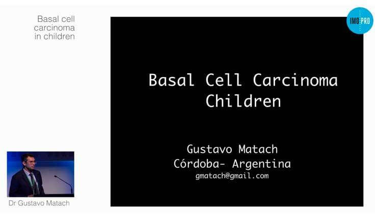 Basal cell carcinoma in children