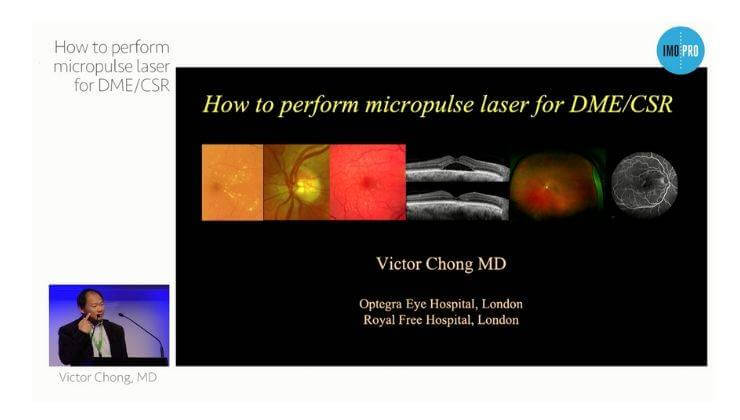How toperform micropulse laser for DME/CSR
