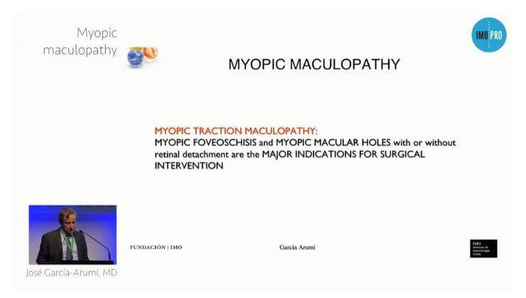 Myopic maculopathy